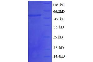 Thiopurine S-Methyltransferase (TPMT) (AA 4-244), (partial) protein (GST tag) (TPMT Protein (AA 4-244, partial) (GST tag))