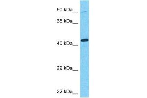 Host:  Rabbit  Target Name:  ARFP2  Sample Type:  Fetal Kidney lysates  Antibody Dilution:  1. (ARFIP2 antibody  (C-Term))