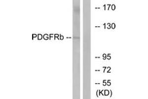 Western Blotting (WB) image for anti-Platelet Derived Growth Factor Receptor beta (PDGFRB) (AA 718-767) antibody (ABIN2889053) (PDGFRB antibody  (AA 718-767))