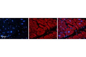 Rabbit Anti-TRIM39 Antibody    Formalin Fixed Paraffin Embedded Tissue: Human Adult heart  Observed Staining: Cytoplasmic Primary Antibody Concentration: 1:600 Secondary Antibody: Donkey anti-Rabbit-Cy2/3 Secondary Antibody Concentration: 1:200 Magnification: 20X Exposure Time: 0. (TRIM39 antibody  (Middle Region))