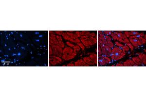Rabbit Anti-TRIM39 Antibody    Formalin Fixed Paraffin Embedded Tissue: Human Adult heart  Observed Staining: Cytoplasmic Primary Antibody Concentration: 1:600 Secondary Antibody: Donkey anti-Rabbit-Cy2/3 Secondary Antibody Concentration: 1:200 Magnification: 20X Exposure Time: 0.