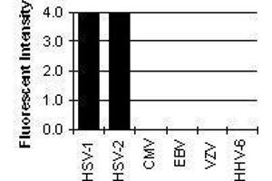 Cross Reactivity Results determined by IFA (HSV gB antibody)