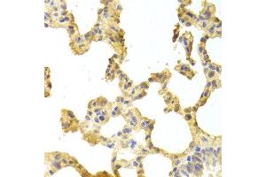 Immunohistochemistry of paraffin-embedded rat lung using TRAF2 antibody at dilution of 1:100 (x400 lens).