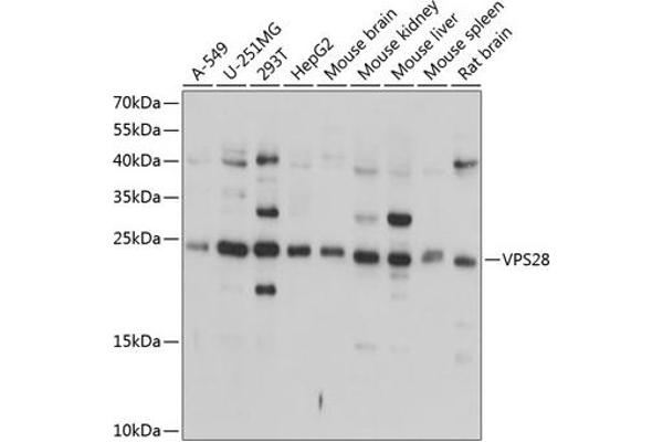 VPS28 Antikörper  (AA 1-221)