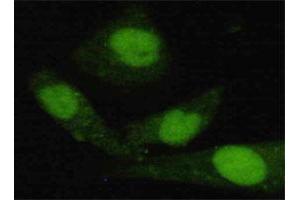 Immunofluorescence staining of HeLa cells using JARID1C monoclonal antibody  at 1:200 dilution. (KDM5C antibody  (C-Term))