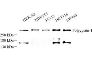 Western blot analysis of Polycystin-1 (ABIN7075124) at dilution of 1: 500 (PKD1 antibody)