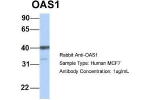 Host: Rabbit  Target Name: OAS1  Sample Tissue: Human MCF7  Antibody Dilution: 1. (OAS1 antibody  (C-Term))