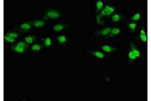 ZNF331 antibody  (AA 179-442)