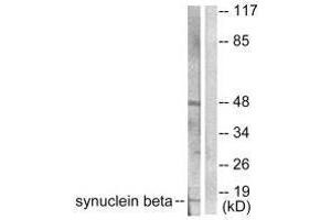 Western Blotting (WB) image for anti-Synuclein, beta (SNCB) antibody (ABIN7182802)
