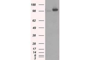 Image no. 2 for anti-Hexokinase 2 (HK2) antibody (ABIN1498647) (Hexokinase 2 antibody)
