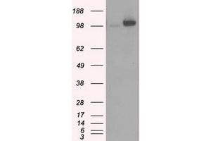 Image no. 2 for anti-Hexokinase 2 (HK2) antibody (ABIN1498647)