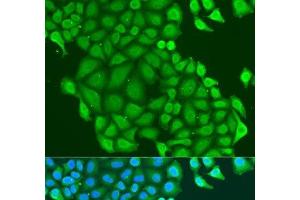 Immunofluorescence analysis of U2OS cells using HAUS6 Polyclonal Antibody at dilution of 1:100. (FAM29A antibody)