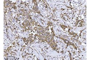 IHC analysis of SCA2/ATXN2 using anti-SCA2/ATXN2 antibody (ABIN7599900). (Ataxin 2 antibody  (AA 1278-1313))