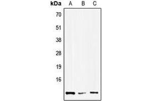 Western blot analysis of HMGN1 expression in Hela (A), NIH3T3 (B), H9C2 (C) whole cell lysates. (HMGN1 antibody  (Center))