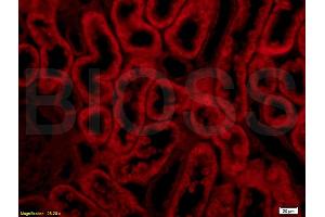 Formalin-fixed and paraffin embedded rat kidney labeled with Anti-Integrin Î±E2 Polyclonal Antibody, Unconjugated (ABIN678758) at 1:200 followed by conjugation to the secondary antibody Goat Anti-Rabbit IgG, PE conjugated used at 1:200 dilution for 40 minutes at 37 °C. (Integrin, alpha E2 (AA 1101-1179) antibody)