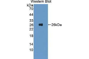 Western blot analysis of the recombinant protein. (FTL antibody  (AA 5-183))