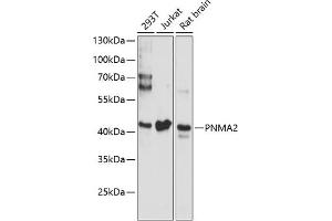 Western blot analysis of extracts of various cell lines, using PNM antibody (ABIN6128525, ABIN6145844, ABIN6145845 and ABIN6220635) at 1:3000 dilution. (PNMA2 antibody  (AA 1-140))