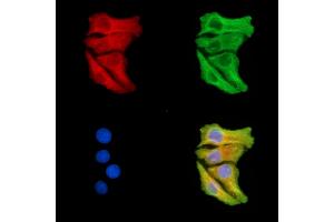 ABIN7095321 and ABIN7099378 staining Hela cells by IF/ICC. (SLC25A37 antibody)
