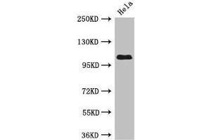 Western Blot Positive WB detected in: Hela whole cell lysate All lanes: USP33 antibody at 3 μg/mL Secondary Goat polyclonal to rabbit IgG at 1/50000 dilution Predicted band size: 107, 104, 94 kDa Observed band size: 107 kDa (USP33 antibody  (C-Term))