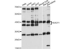 Western blot analysis of extracts of various cell lines, using SUGT1 antibody (ABIN6293563) at 1:1000 dilution. (SUGT1 antibody)