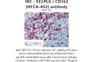 Image no. 2 for anti-Selectin P Ligand (SELPLG) antibody (ABIN5693705) (SELPLG antibody)