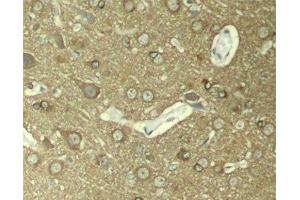 Immunohistochemistry of paraffin-embedded Rat hippocampal region tissue from a model with Alzheimer, using Phospho-Tau(S404) Polyclonal Antibody (tau antibody  (pSer404))