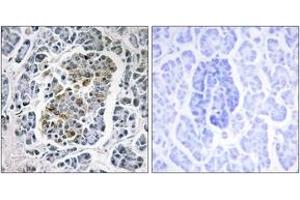 Immunohistochemistry analysis of paraffin-embedded human pancreas tissue, using MtSSB Antibody. (SSBP1 antibody  (AA 99-148))