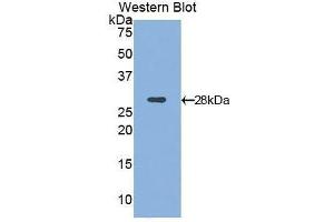 Western Blotting (WB) image for anti-Integrin alpha D (ITGAD) (AA 886-1106) antibody (ABIN1859492) (ITGAD antibody  (AA 886-1106))