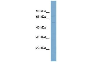 WB Suggested Anti-SLC7A1 Antibody Titration:  0. (SLC7A1 antibody  (N-Term))