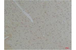 Immunohistochemistry (IHC) analysis of paraffin-embedded Rat Brain Tissue using KCNK10 (TREK-2) Rabbit Polyclonal Antibody diluted at 1:200. (KCNK10 antibody)