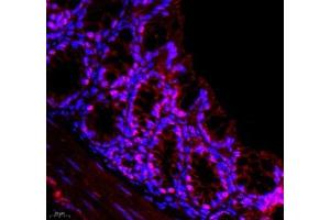 Immunofluorescence of paraffin embedded mouse colon using DMRTA2 (ABIN7073753) at dilution of 1: 650 (400x lens) (DMRTA2 antibody)