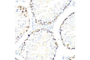 Immunohistochemistry of paraffin-embedded mouse testis using DDX50 antibody (ABIN6129371, ABIN6139509, ABIN6139510 and ABIN6224730) at dilution of 1:100 (40x lens).