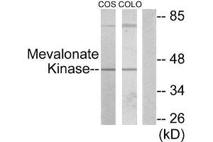 Western Blotting (WB) image for anti-Mevalonate Kinase (MVK) (Internal Region) antibody (ABIN1849535) (MVK antibody  (Internal Region))