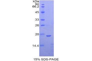 SDS-PAGE (SDS) image for Angiopoietin 1 (ANGPT1) (AA 304-450) protein (His tag) (ABIN1877424)