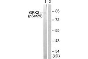 Western blot analysis of extracts from Jurkat cells treated with EGF 200ng/ml 30', using GRK2 (Phospho-Ser29) Antibody.