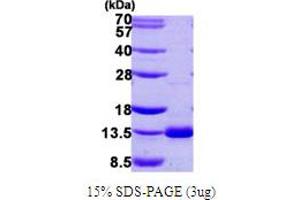 SDS-PAGE (SDS) image for Dynein, Axonemal, Light Chain 4 (DNAL4) (AA 1-105) protein (His tag) (ABIN667455)