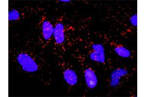 Proximity Ligation Analysis of protein-protein interactions between NEFL and APP. (NEFL antibody  (AA 1-543))