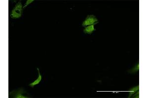 Immunofluorescence of monoclonal antibody to PRKDC on HeLa cell.