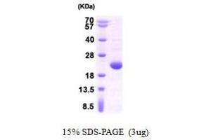 Figure annotation denotes ug of protein loaded and % gel used. (APRT Protein (AA 1-180))