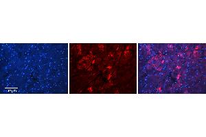 Rabbit Anti-MFN2 Antibody   Formalin Fixed Paraffin Embedded Tissue: Human Heart Tissue Observed Staining: Cytoplasm in cardiomyocytes Primary Antibody Concentration: 1:100 Other Working Concentrations: N/A Secondary Antibody: Donkey anti-Rabbit-Cy3 Secondary Antibody Concentration: 1:200 Magnification: 20X Exposure Time: 0. (MFN2 antibody  (C-Term))