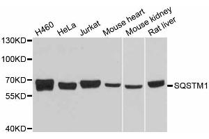 Western blot analysis of extracts of various cell lines, using SQSTM1 antibody (ABIN6290793) at 1:1000 dilution.