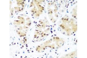 Immunohistochemistry of paraffin-embedded Human stomach using Argonaute-2 Polyclonal Antibody at dilution of 1:100 (40x lens). (AGO2 antibody)