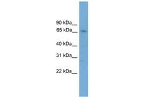 Image no. 1 for anti-Zinc Finger Protein 192 (ZNF192) (AA 201-250) antibody (ABIN6744623) (ZNF192 antibody  (AA 201-250))