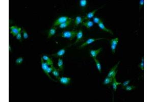 Immunofluorescence staining of Hela cells with ABIN7161797 at 1:155, counter-stained with DAPI. (NFATC3 antibody  (AA 887-1070))