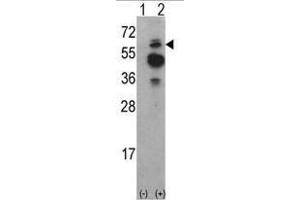 Image no. 1 for anti-tyrosine Kinase, Non-Receptor, 2 (TNK2) (N-Term) antibody (ABIN452711) (TNK2 antibody  (N-Term))