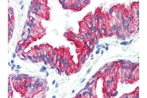 Immunohistochemistry staining of human prostate (paraffin sections) using anti-cytokeratin 8(C-43). (KRT8 antibody)