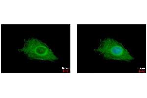 ICC/IF Image FIG4 antibody detects FIG4 protein at cytoplasm by immunofluorescent analysis.