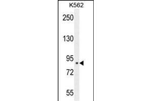 CLIC6 Antibody (Center) (ABIN654431 and ABIN2844167) western blot analysis in K562 cell line lysates (35 μg/lane). (CLIC6 antibody  (AA 539-565))