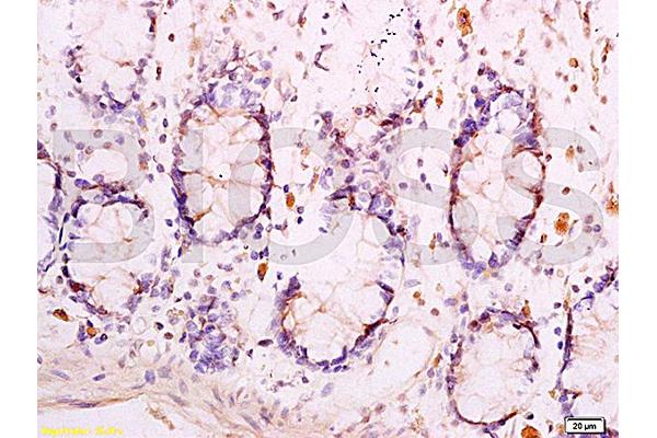 Adiponectin Receptor 1 antibody  (AA 241-270)
