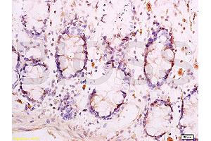 Formalin-fixed and paraffin embedded human rectal tissue labeled with Anti-Adiponectin Receptor 1 Polyclonal Antibody (ABIN670836), Unconjugated at 1:300, followed by conjugation to the secondary antibody and DAB staining